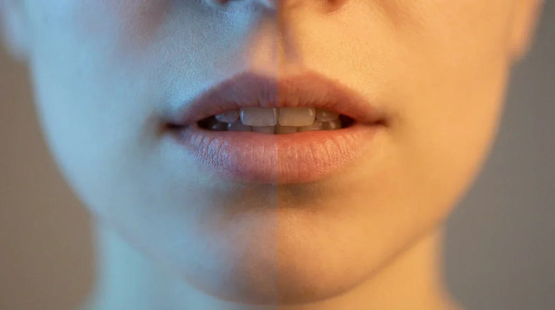 Upper Decky vs. Lower Decky: Are You Placing Your Nic Pouch Wrong?